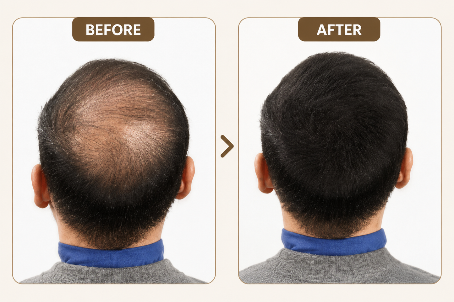 Precision Massage & Serum Roller for Better Absorption