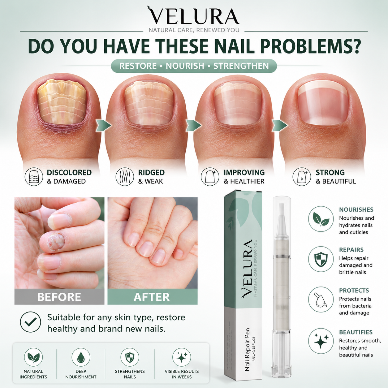 Nail Repair & Care Pen